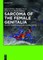 Smooth muscle and stromal tumors and prevention of inadequate surgery