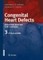Congenital Heart Defects