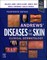 Andrews' Diseases of the Skin