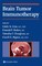 Brain Tumor Immunotherapy