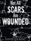 Not All Scars Are Wounded
