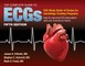 The Complete Guide to Ecgs: A Comprehensive Study Guide to Improve ECG Interpretation Skills