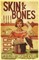 Skin & Bones