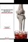 Sugar-Sweetened Beverage and Bone Health